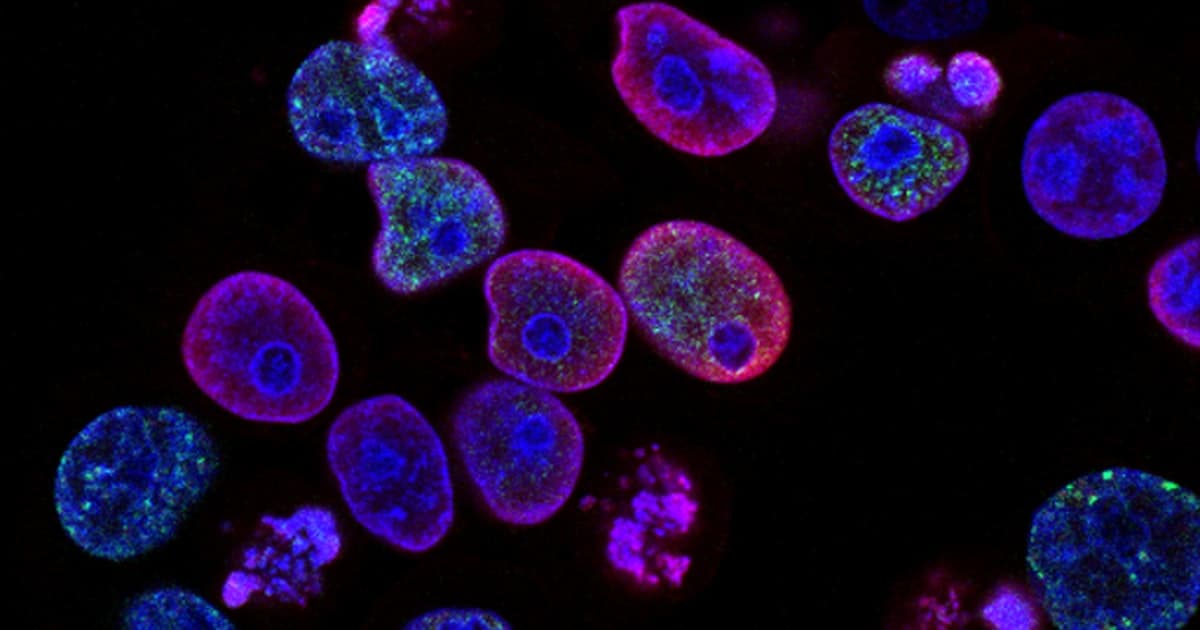 EU Grants for Biotech and CBRN Detection Companies